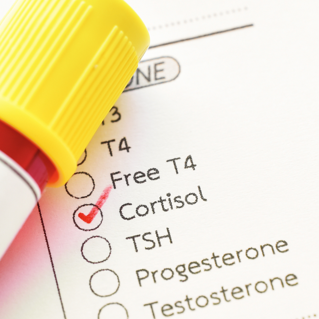 Cortisol test