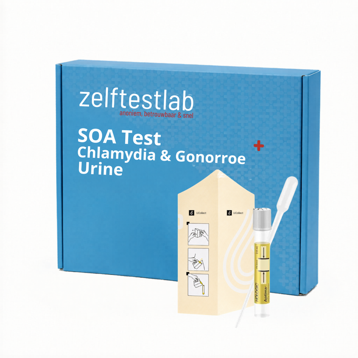 Chlamydia en gonorroe urine Zelftestlab