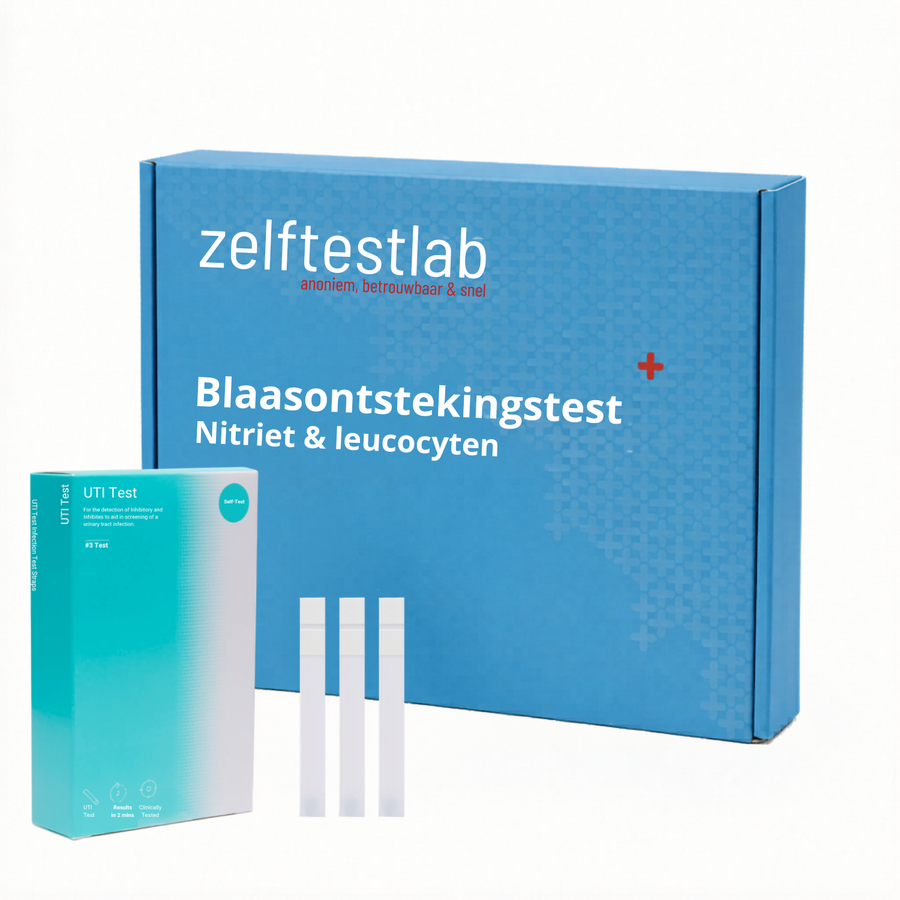 Blaasontsteking test