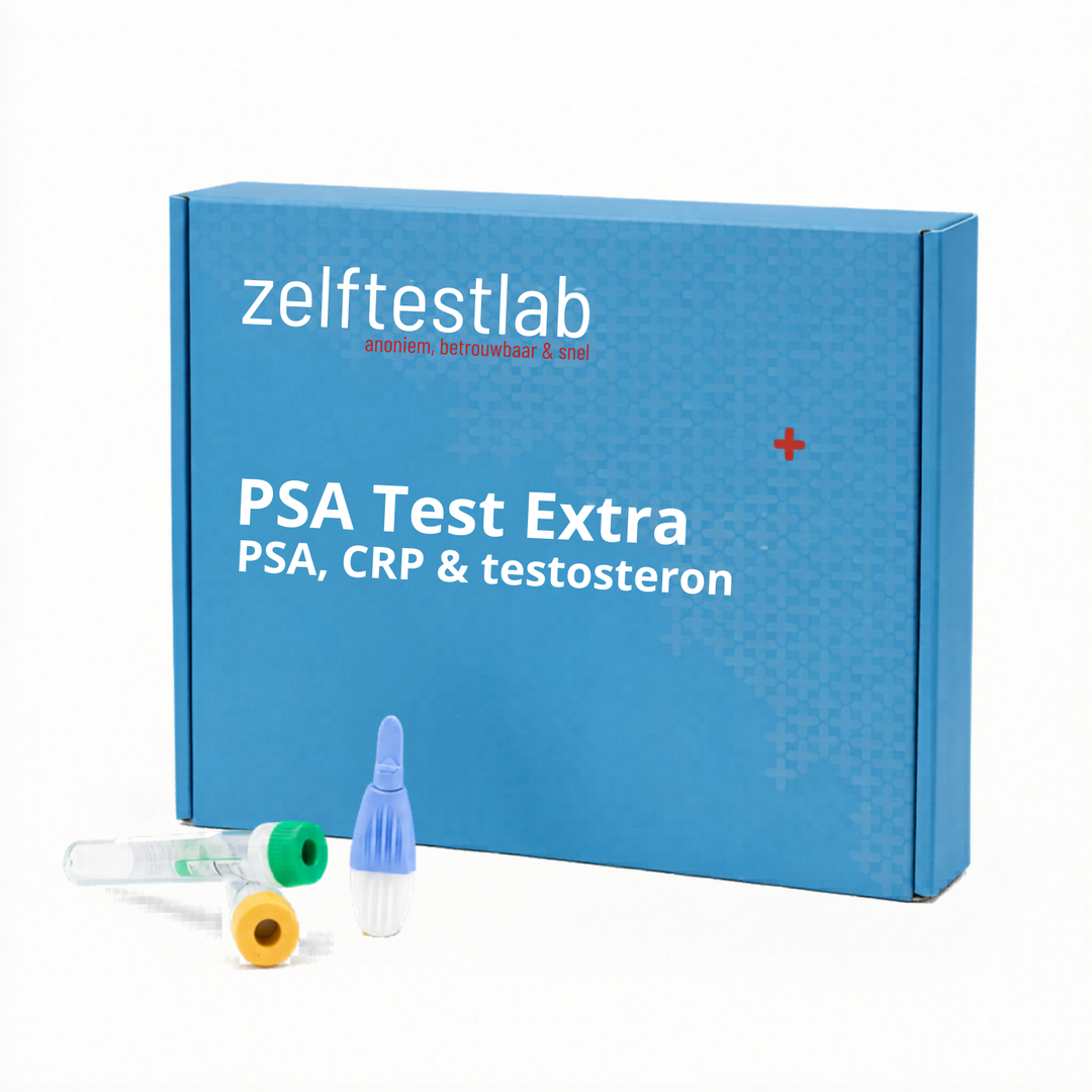 PSA extra test