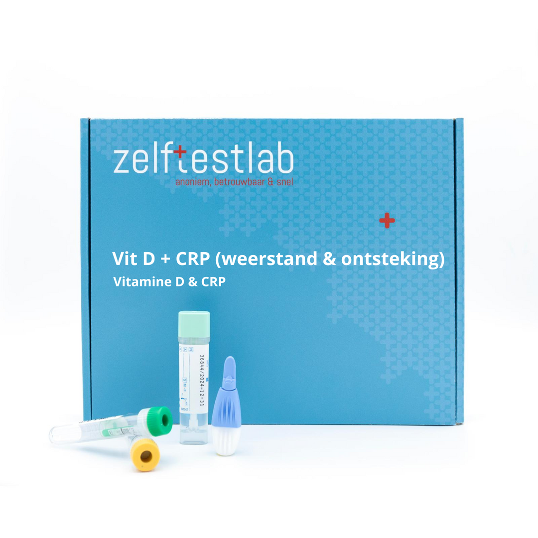 Weerstand & onstekingstest